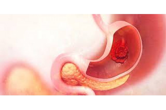 Nghiên cứu độc tính của bài thuốc DDHV điều trị viêm loét dạ dày do vi khuẩn HELICOBACTER PYLORI trên thực nghiệm