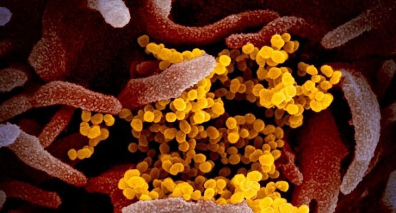 Giải mã gene để chẩn đoán người nhiễm virus corona