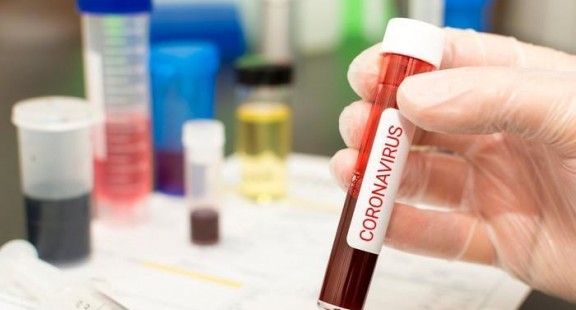 Bắt đầu thử nghiệm nguyên mẫu vaccine ngừa virus corona chủng mới
