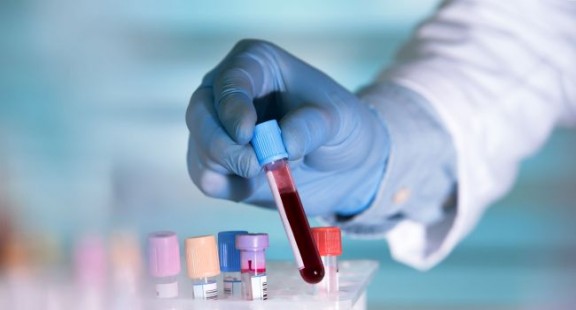 Phát hiện kháng thể ức chế virus corona ở bệnh nhân SARS 17 năm trước