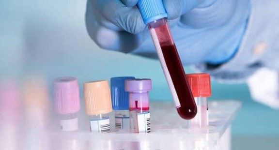 Các nhà khoa học đã tìm ra nguồn gốc của đông máu do Covid-19
