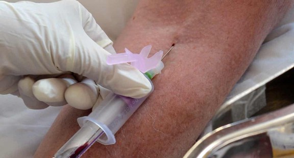 Xét nghiệm máu có thể dò được ung thư nhiều năm trước khi có triệu chứng