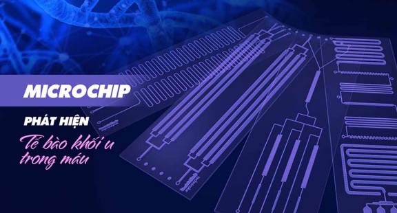Microchip phát hiện tế bào khối u trong máu