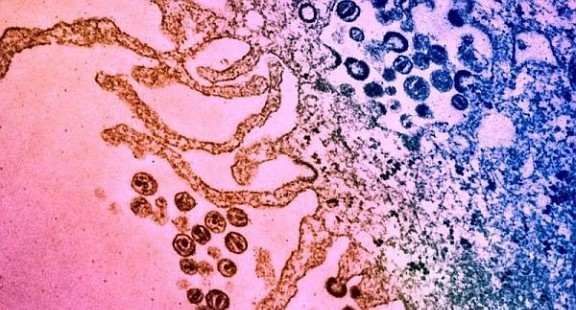 Phân tử kháng sinh cho phép hệ miễn dịch tiêu diệt tế bào nhiễm HIV