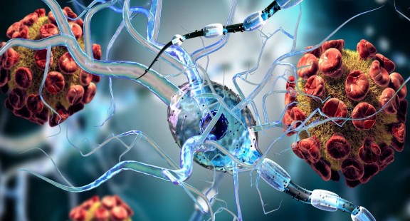 Virus SARS-CoV-2 có thể tấn công các tế bào não
