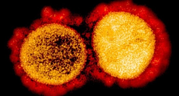Chủng Coronavirus đột biến, chiếm ưu thế hơn có thể lây nhiễm?