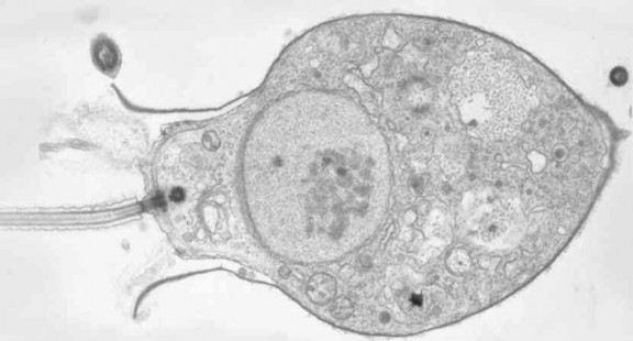 Các nhà khoa học vừa phát hiện hai loài sinh vật đầu tiên ăn virus, và điều đó có ý nghĩa cực kỳ quan trọng
