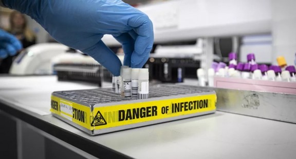 Virus SARS-CoV-2 có cơ chế xâm nhập phức tạp