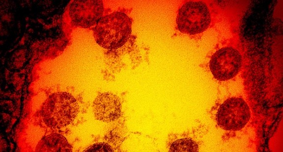 Nghiên cứu mới về thời gian virus SARS-CoV-2 tồn tại trên da người