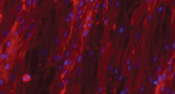 Công nghệ lai ghép hydrogel mở đường cho kỹ thuật mô nhân tạo