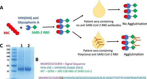 Phát triển bộ test tìm kháng thể chống lại coronavirus với giá rẻ