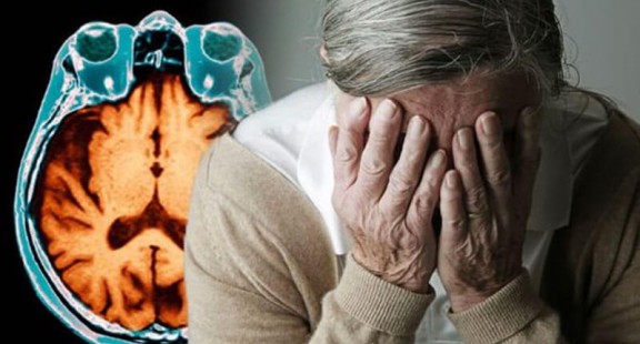 Thuốc thử nghiệm cho thấy tiềm năng chống lại bệnh Alzheimer