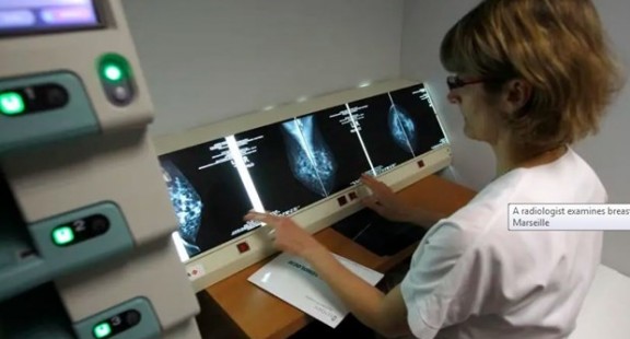 Phát hiện mới giúp cảnh báo sớm bệnh ung thư sắp chuyển sang di căn