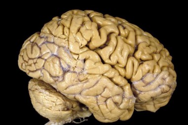 Tạo ra não người, khoa học đang ‘đi quá giới hạn’?