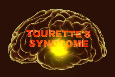 Hội chứng Tourette: Một góc nhìn mới