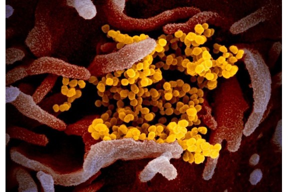 Giải mã gene để chẩn đoán người nhiễm virus corona