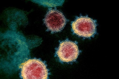 Các nhà khoa học Mỹ đã chế tạo được vắc-xin virus corona