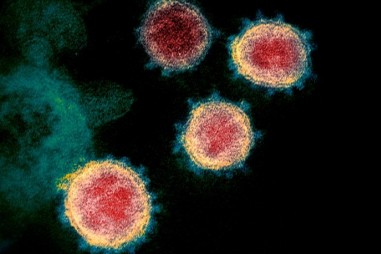Tại sao coronavirus lan nhanh dễ dàng giữa người với người?