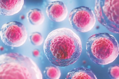 Ghép tế bào gốc giúp giảm viêm và tổn thương ở bệnh nhân Covid-19