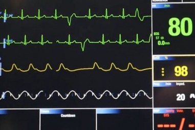 AI – Dụng cụ mới để chẩn đoán tim mạch