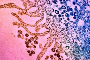 Phân tử kháng sinh cho phép hệ miễn dịch tiêu diệt tế bào nhiễm HIV