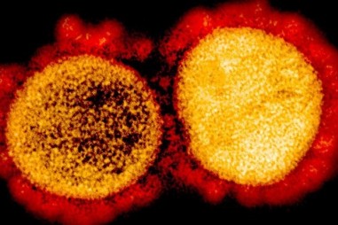 Chủng Coronavirus đột biến, chiếm ưu thế hơn có thể lây nhiễm?