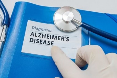 Các xét nghiệm mới xác định sớm bệnh Alzheimer  trước khi xuất hiện các triệu chứng