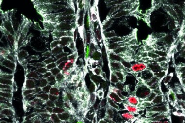 Khám phá các cơ chế cơ bản của quá trình tự tái sinh và biệt hóa tế bào gốc ở ruột