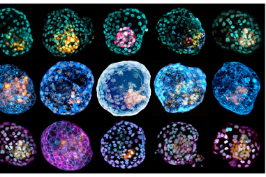 Công bố mô hình bào thai người đầu tiên tạo nên từ tế bào da