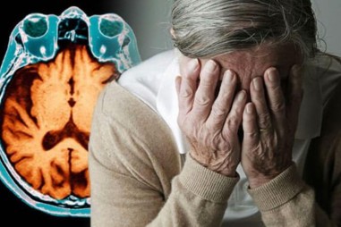 Thuốc thử nghiệm cho thấy tiềm năng chống lại bệnh Alzheimer