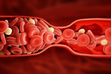 Đông máu có thể là nguyên nhân gốc rễ của hội chứng COVID kéo dài
