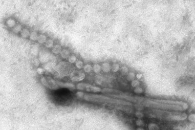 Biến thể gen hiếm làm tăng khả năng bị nhiễm cúm gia cầm H7N9