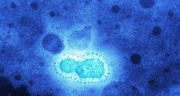 Phát hiện mới về đại dịch do virus corona tấn công 20.000 năm trước