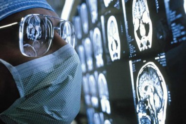 Thử nghiệm siêu âm mang lại hy vọng cho bệnh nhân ung thư não