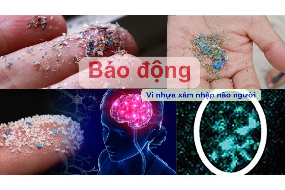 Báo động: Vi nhựa xâm nhập não người với tốc độ nhanh